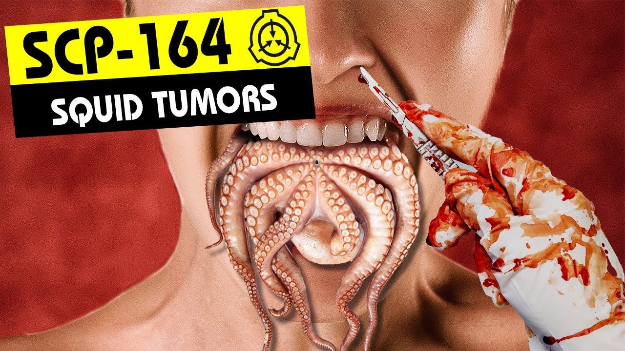 SCP-164